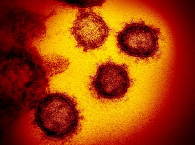 Coronavirusul văzut la microscop - Cercetătorii au publicat imagini / GALERIE FOTO